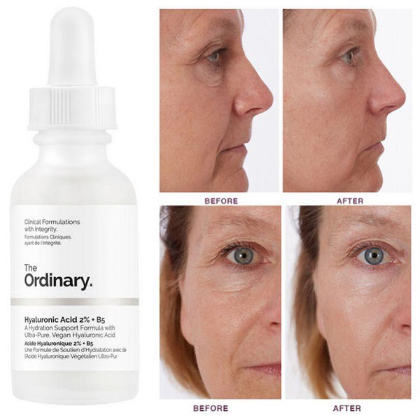 The Ordinary Hyaluronic Acid 2 B5 Hydration Support Formula 6