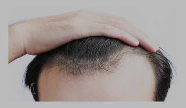 قرص تقویت کننده مو هیرتامین - 1 شاخص